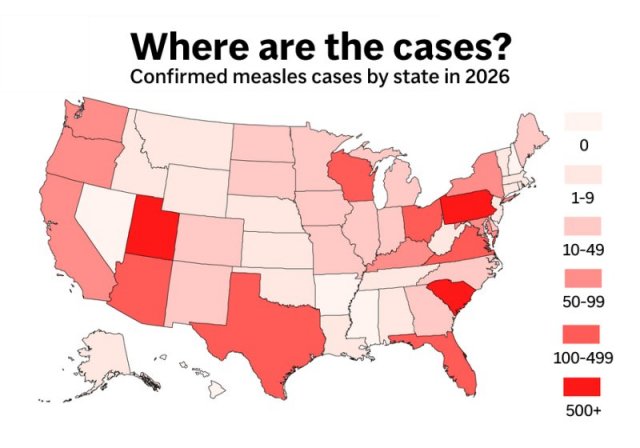 Measles cases by state in 2026