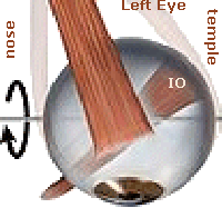 Left Inferior Oblique Muscle
